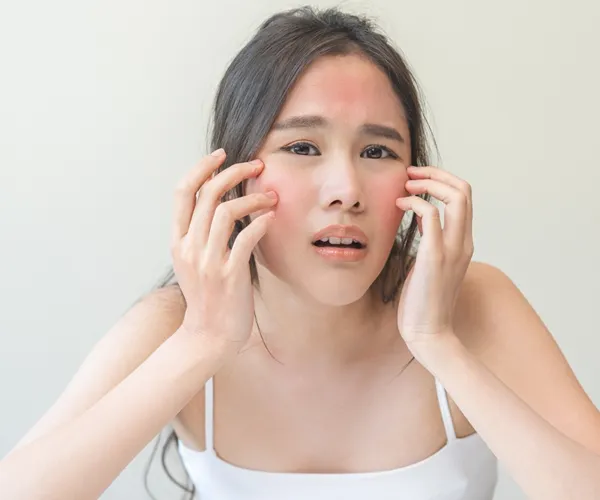 Dermatological Diseases Treatment