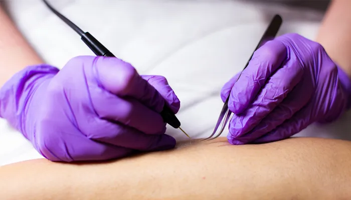 Electrolysis