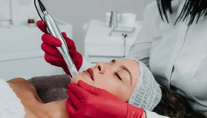Image of Microneedling with PRP Section 3