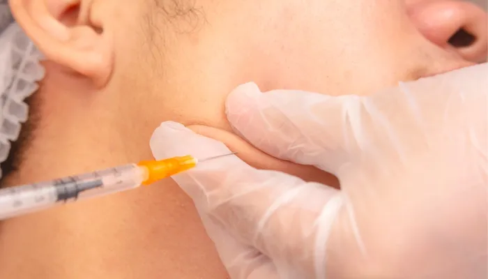 Jawline Anti-Wrinkle Treatment